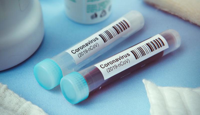 Castilla-La Mancha confirma 22 nuevos casos por infección de coronavirus