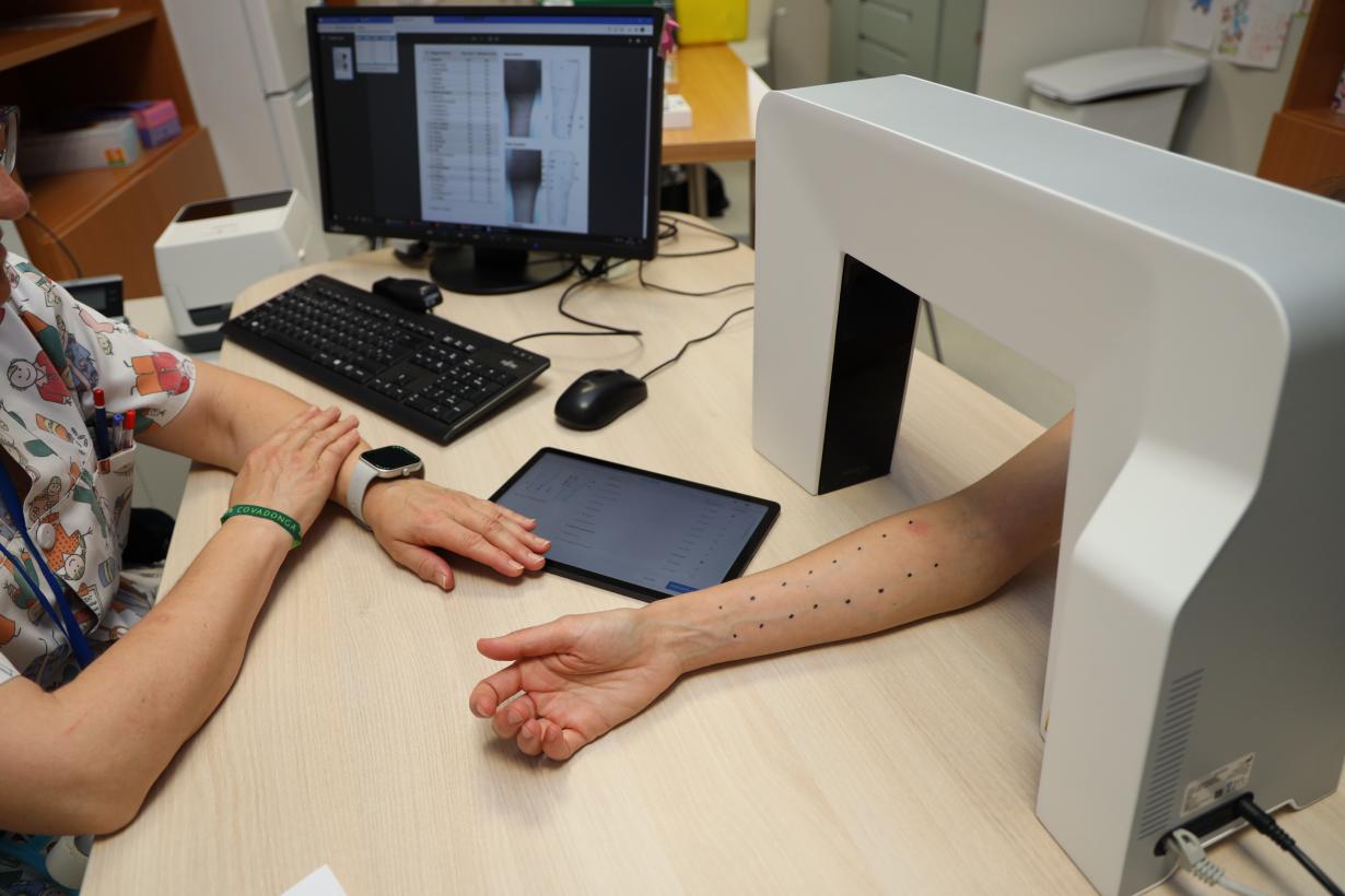 El Hospital Universitario de Toledo incorpora una nueva herramienta digital para la lectura de las pruebas cutáneas del servicio de Alergología